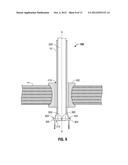 Single Incision Deployable Platform diagram and image