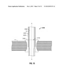 Single Incision Deployable Platform diagram and image