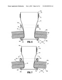 SURGICAL ACCESS ASSEMBLY WITH SLEEVE AND ADJUSTABLE FASTENER diagram and image