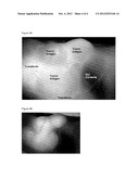 Methods and Reagents for in Vivo Imaging of Cancel Cell Lines diagram and image