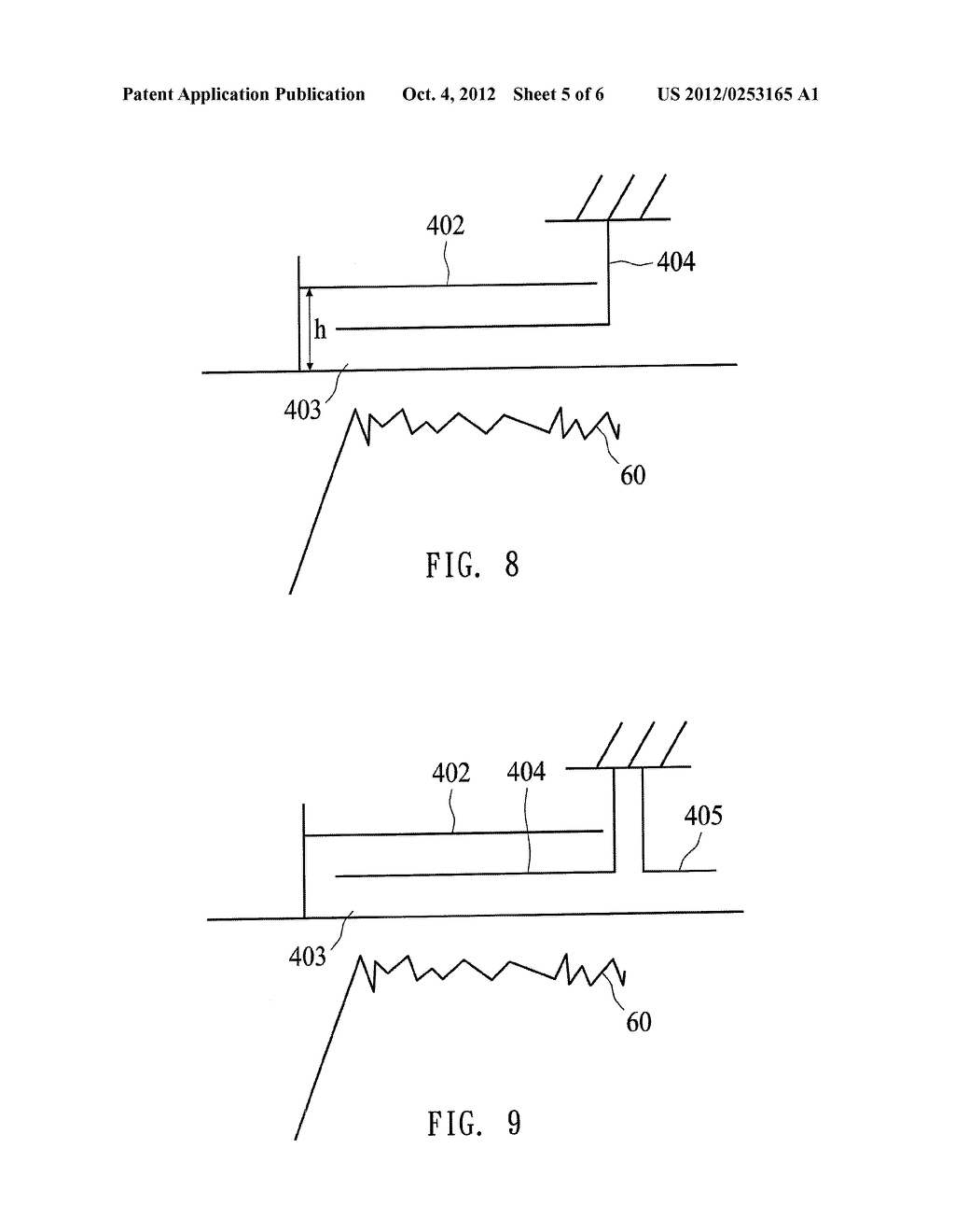 INTRAOCULAR PRESSURE DETECTING DEVICE AND DETECTING METHOD THEREOF - diagram, schematic, and image 06