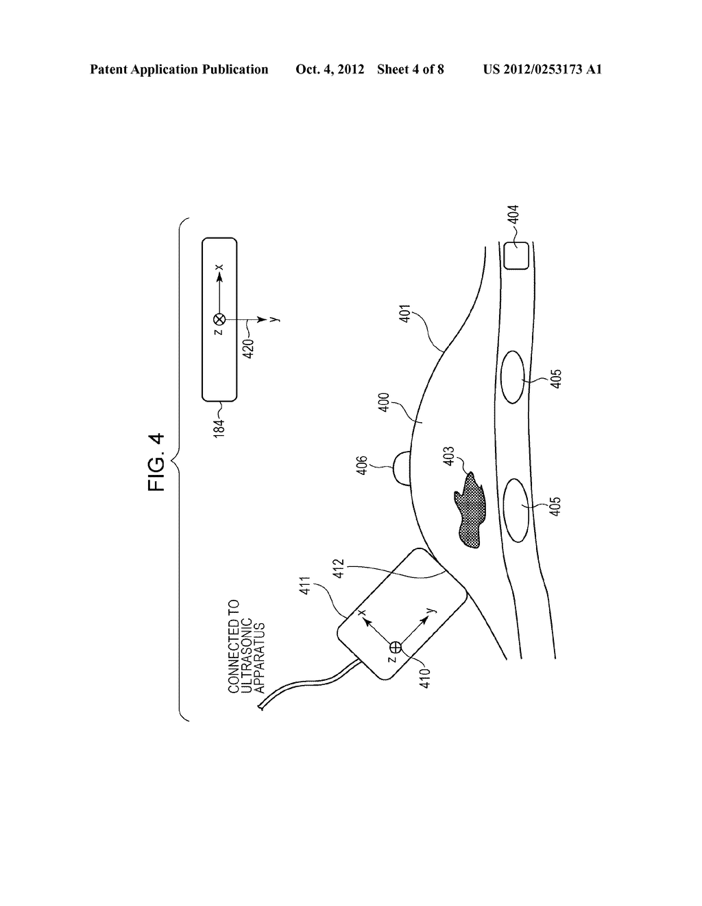 IMAGE PROCESSING APPARATUS, ULTRASONIC PHOTOGRAPHING SYSTEM, IMAGE     PROCESSING METHOD THEREFOR, AND STORAGE MEDIUM STORING PROGRAM - diagram, schematic, and image 05