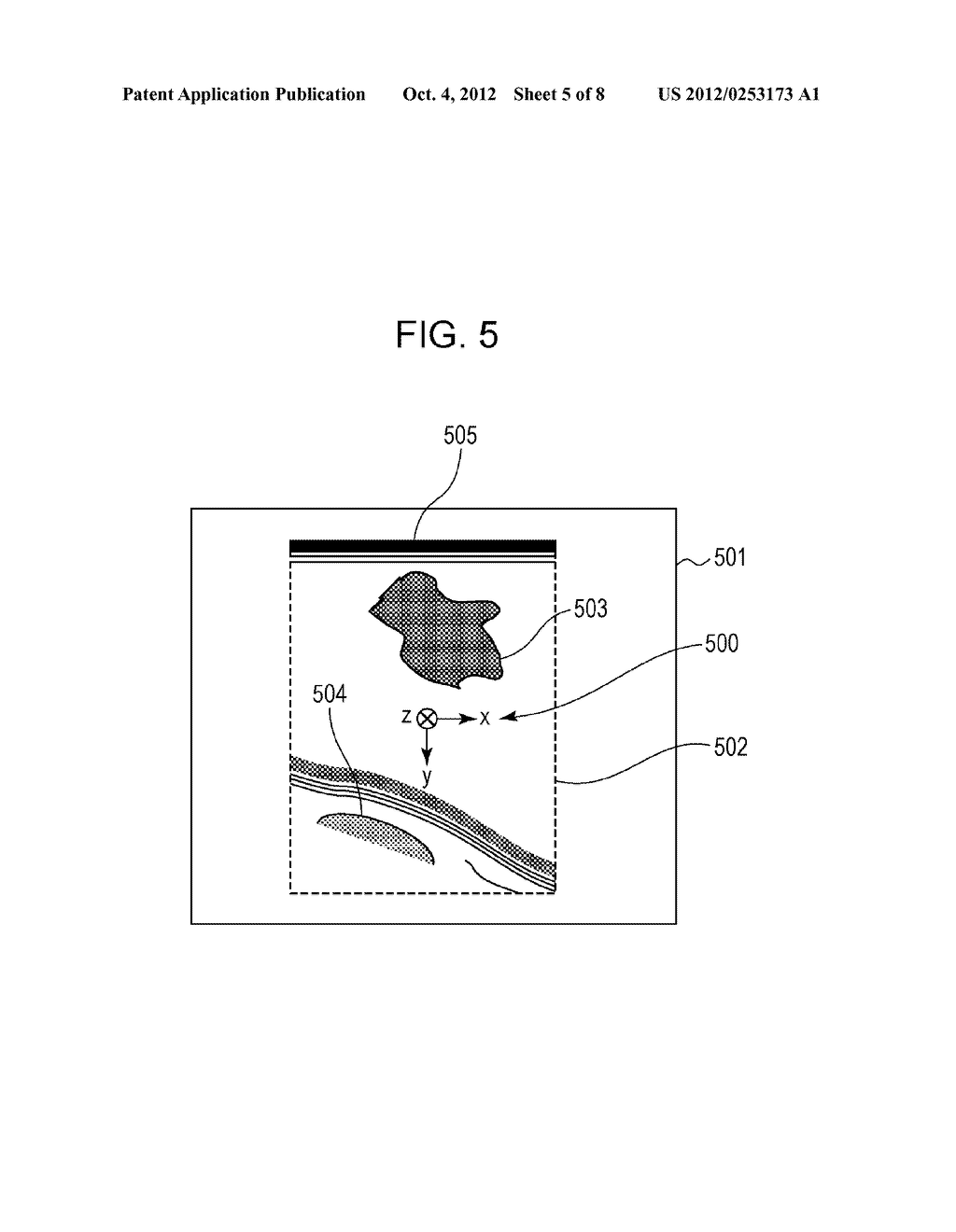 IMAGE PROCESSING APPARATUS, ULTRASONIC PHOTOGRAPHING SYSTEM, IMAGE     PROCESSING METHOD THEREFOR, AND STORAGE MEDIUM STORING PROGRAM - diagram, schematic, and image 06