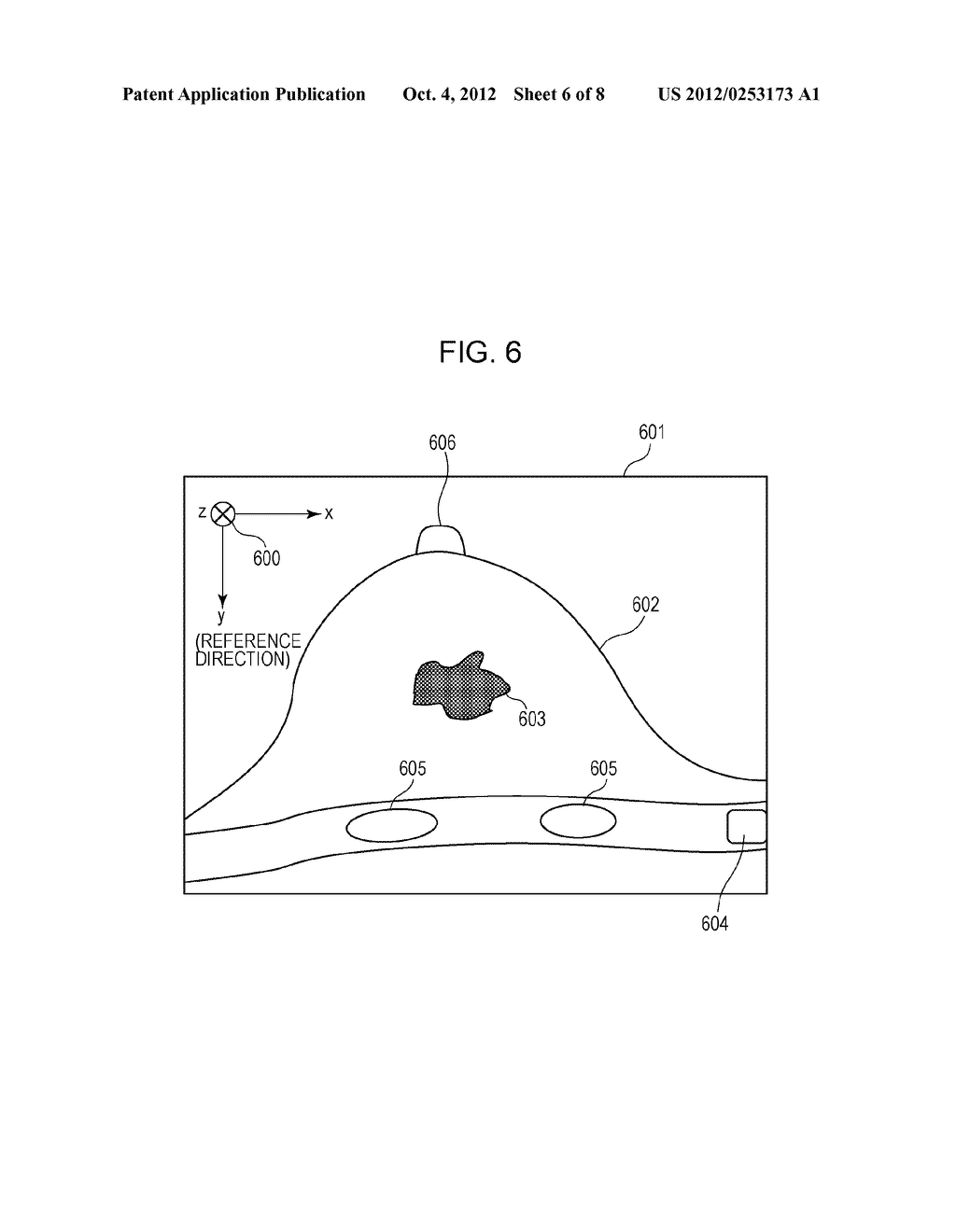 IMAGE PROCESSING APPARATUS, ULTRASONIC PHOTOGRAPHING SYSTEM, IMAGE     PROCESSING METHOD THEREFOR, AND STORAGE MEDIUM STORING PROGRAM - diagram, schematic, and image 07