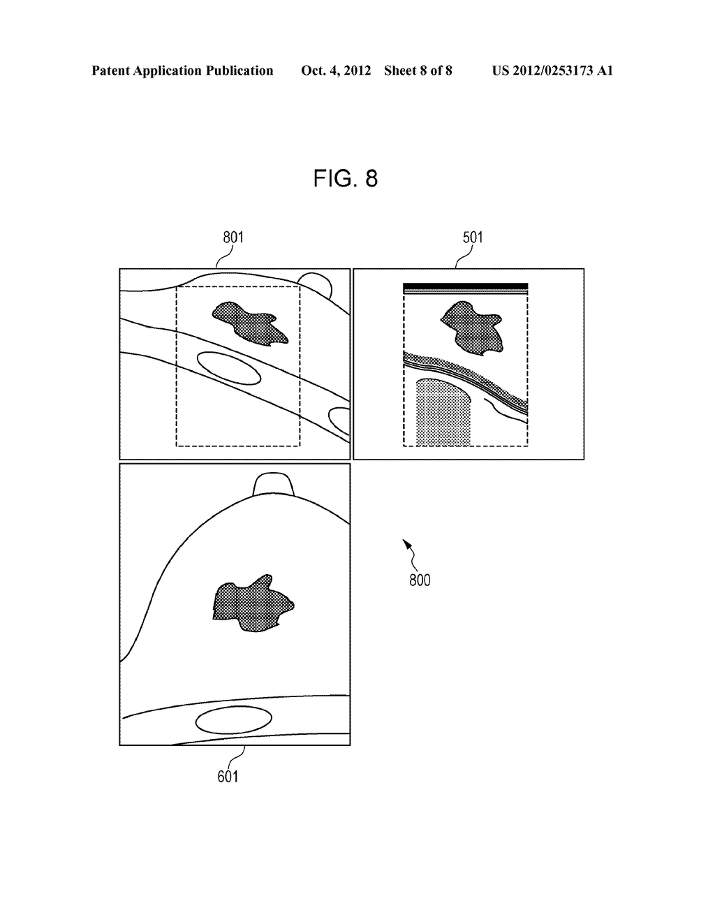 IMAGE PROCESSING APPARATUS, ULTRASONIC PHOTOGRAPHING SYSTEM, IMAGE     PROCESSING METHOD THEREFOR, AND STORAGE MEDIUM STORING PROGRAM - diagram, schematic, and image 09