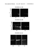 COMBINED ULTRASOUND AND PHOTOACOUSTIC IMAGING OF METAL OBJECTS diagram and image