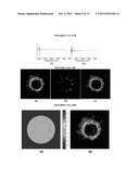 COMBINED ULTRASOUND AND PHOTOACOUSTIC IMAGING OF METAL OBJECTS diagram and image