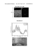 COMBINED ULTRASOUND AND PHOTOACOUSTIC IMAGING OF METAL OBJECTS diagram and image