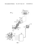 METHODS AND SYSTEMS FOR CHEMICAL ABLATION diagram and image