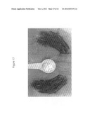 METHODS AND SYSTEMS FOR CHEMICAL ABLATION diagram and image