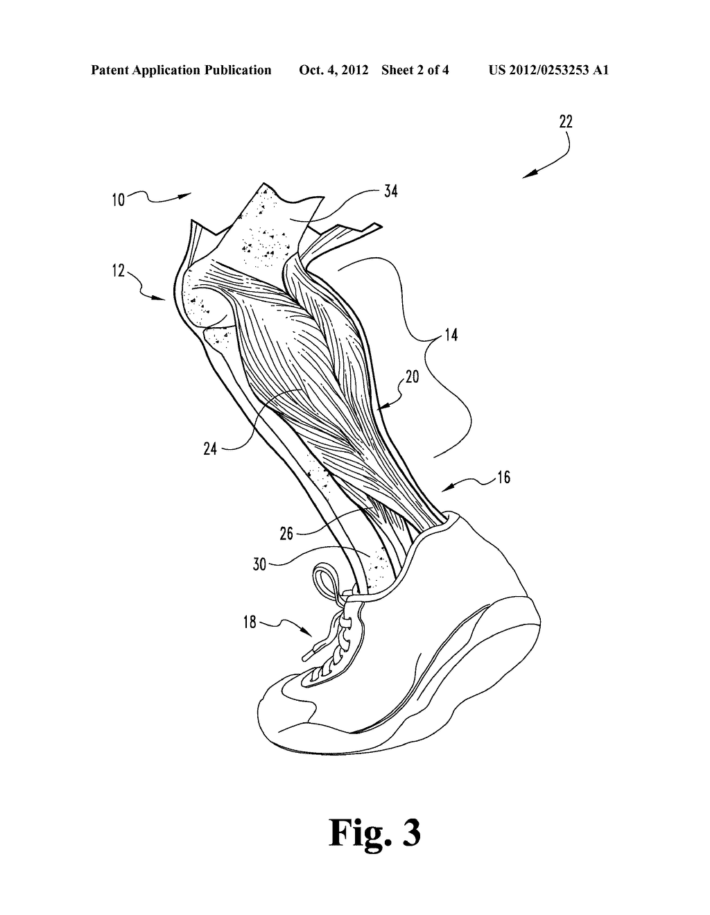 Adjustable-Sole, Hinged Equinus Brace With Toe Wedge - diagram, schematic, and image 03