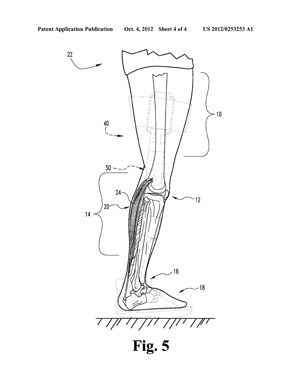 Adjustable-Sole, Hinged Equinus Brace With Toe Wedge - diagram, schematic, and image 05