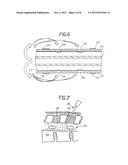 Extradural Infusion Suction System and Method to Drain Fluid Collection in     the Extradural Space of Spinal Cord diagram and image