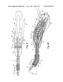 SURGICAL INSTRUMENT diagram and image