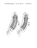 SURGICAL INSTRUMENT diagram and image