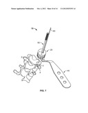 PEDICLE DRILL GUIDE FOR SPINAL SURGERY diagram and image