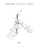 PEDICLE DRILL GUIDE FOR SPINAL SURGERY diagram and image