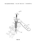 PEDICLE DRILL GUIDE FOR SPINAL SURGERY diagram and image