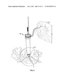 PEDICLE DRILL GUIDE FOR SPINAL SURGERY diagram and image