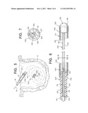 OCCLUSIVE DEVICE WITH POROUS STRUCTURE AND STRETCH RESISTANT MEMBER diagram and image
