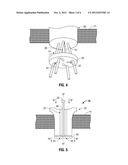 Triangulation Mechanism For Access Ports diagram and image