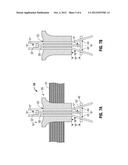 Triangulation Mechanism For Access Ports diagram and image