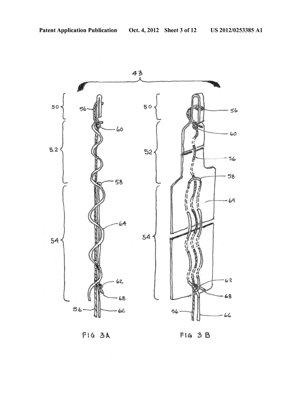 CLOSURE MEDICAL DEVICE AND DELIVERY MECHANISM - diagram, schematic, and image 04