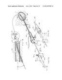 CLOSURE MEDICAL DEVICE AND DELIVERY MECHANISM diagram and image