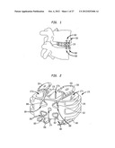 INTERVERTEBRAL IMPLANT WITH INTEGRATED FIXATION diagram and image