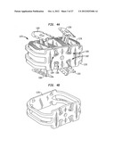 INTERVERTEBRAL IMPLANT WITH INTEGRATED FIXATION diagram and image