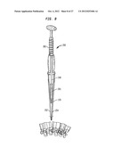 INTERVERTEBRAL IMPLANT WITH INTEGRATED FIXATION diagram and image