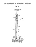 INTERVERTEBRAL IMPLANT WITH INTEGRATED FIXATION diagram and image