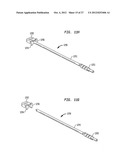 INTERVERTEBRAL IMPLANT WITH INTEGRATED FIXATION diagram and image