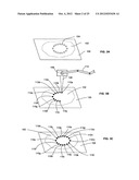 Skin treatment including patterned light diagram and image