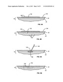 Skin treatment including patterned light diagram and image