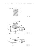 Skin treatment including patterned light diagram and image