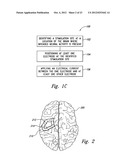 METHODS AND APPARATUS FOR EFFECTUATING A LASTING CHANGE IN A     NEURAL-FUNCTION OF A PATIENT diagram and image