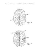 METHODS AND APPARATUS FOR EFFECTUATING A LASTING CHANGE IN A     NEURAL-FUNCTION OF A PATIENT diagram and image