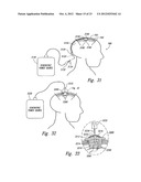 METHODS AND APPARATUS FOR EFFECTUATING A LASTING CHANGE IN A     NEURAL-FUNCTION OF A PATIENT diagram and image