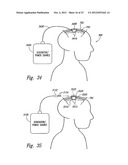 METHODS AND APPARATUS FOR EFFECTUATING A LASTING CHANGE IN A     NEURAL-FUNCTION OF A PATIENT diagram and image
