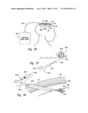 METHODS AND APPARATUS FOR EFFECTUATING A LASTING CHANGE IN A     NEURAL-FUNCTION OF A PATIENT diagram and image