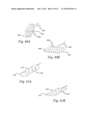 METHODS AND APPARATUS FOR EFFECTUATING A LASTING CHANGE IN A     NEURAL-FUNCTION OF A PATIENT diagram and image