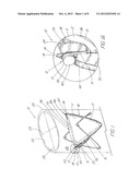 Prosthesis Adapted for Placement Under External Imaging diagram and image