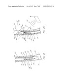 Prosthesis Adapted for Placement Under External Imaging diagram and image