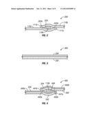 FIGURE MOULDING AND WEIGHT LOSS AID SYSTEMS AND METHODS diagram and image