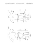 FIGURE MOULDING AND WEIGHT LOSS AID SYSTEMS AND METHODS diagram and image