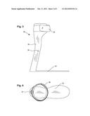 Ankle-Foot Orthosis diagram and image