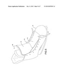 METHOD AND APPARATUS FOR PROTECTING A FOOT diagram and image