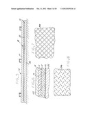 FISHING POLE GRIP diagram and image