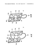 DRAIN HOSE CLIP FOR A WASHER diagram and image